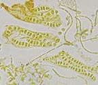 Acanthothecis floridensis spores