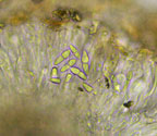 Arthonia floridana spores