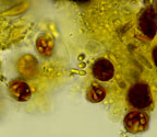 Arthonia microsperma spores