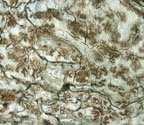 Arthonia platyspilea
