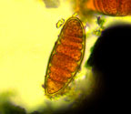 Arthonia pseudostromatica spore