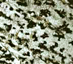 Arthonia simplicascens
