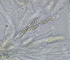 Aspidothelium cinerascens 