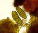 Cryptothecia calusarum spores