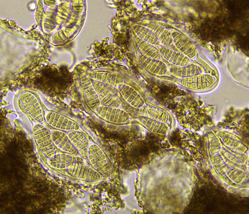 Cryptothecia fuscopunctata asci/ascospores