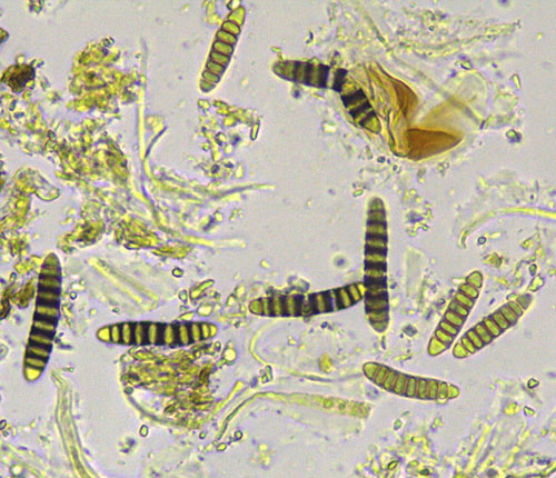 Diorygma basinigrum ascospores