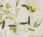 Diorygma basinigrum spores