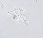 Enterographa anguinella