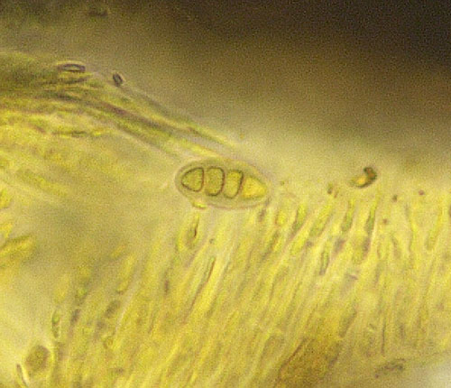 Fissurina crassilabra ascospore