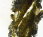 Fissurina hyalinella thin section