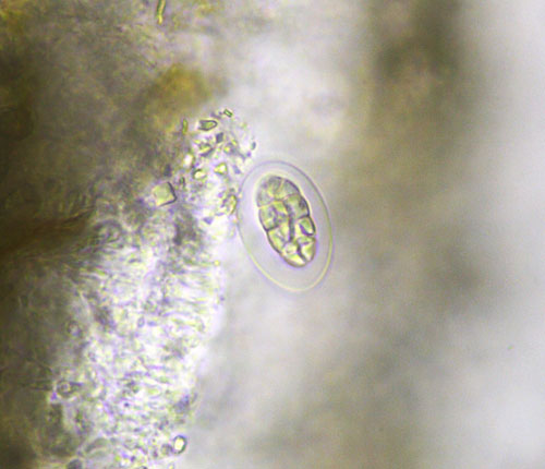 Fissurina intercludens ascospore