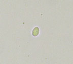Malmidea fuscella
