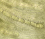 Monoblastia palmicola