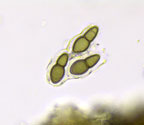Mycomicrothelia apposita