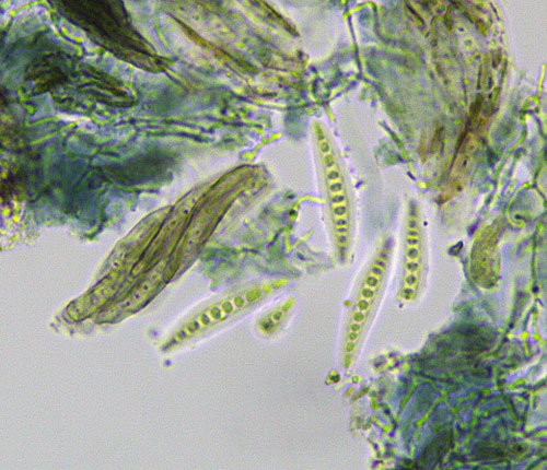 Opegrapha gyrophorica spores