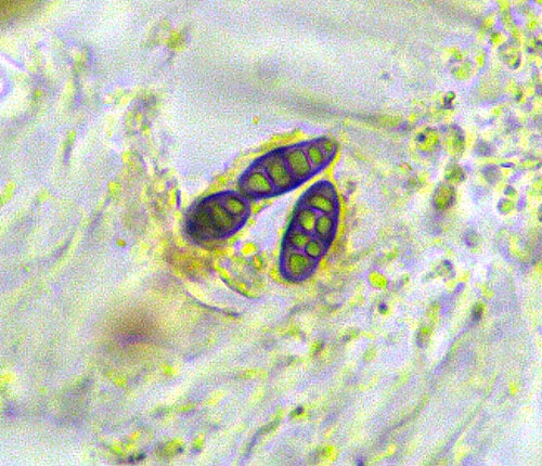 Pycnotrema pycnoporellum spores