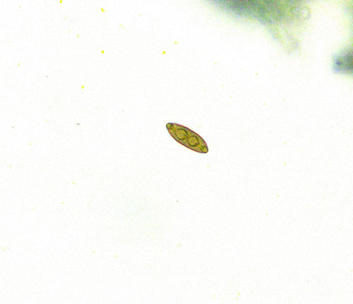 Pyrenula circumfiniens - spore