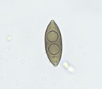 Pyrenula cuyabensis spore