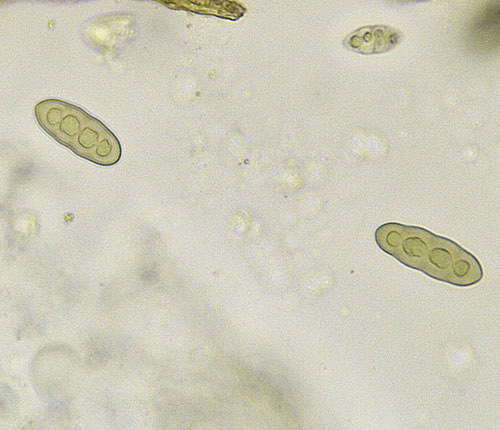 Pyrenula gahavisukana ascospores