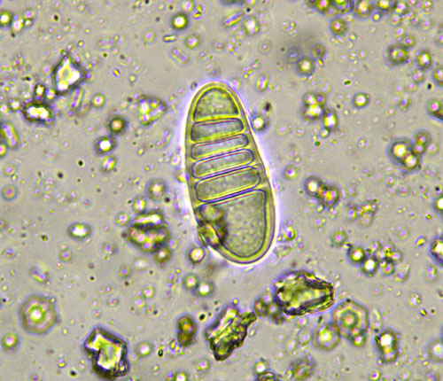 Stirtonia alba ascospores