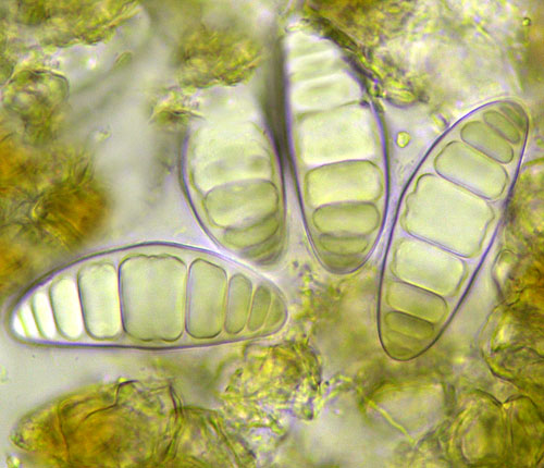 Stirtonia divaricatica spores