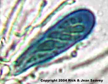 Byssoloma leucoblepharum ascus.