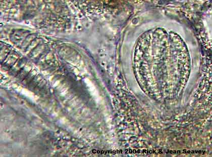 Arthonia platygraphidea asci and spores.