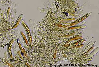 Arthopyrenula cinchonae asci.