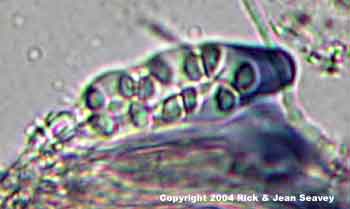 Caloplaca flavovirescens stained ascus.