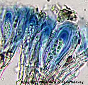 Coccocarpia erythroxyli asci.