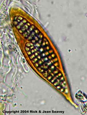 Diorygma poitaei stained ascus.