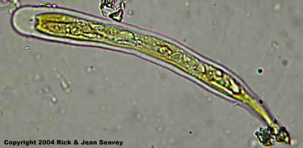 Diorygma poitaei unstained ascus.