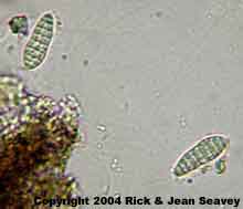 Arthothelium taediosum spores.