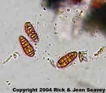 Arthothelium taediosum stained spores.