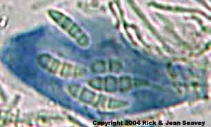 Byssoloma leucoblepharum spores.