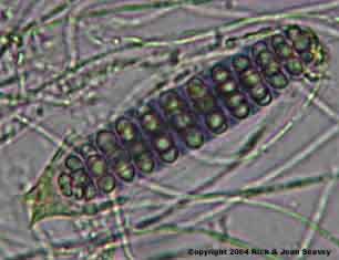 Diorygma poitaei stained spore.