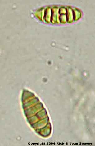 Gyrostomum scyphuliferum spores.