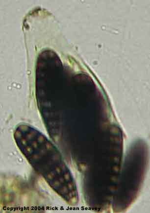 Gyrostomum scyphuliferum staoined spores in ascus.