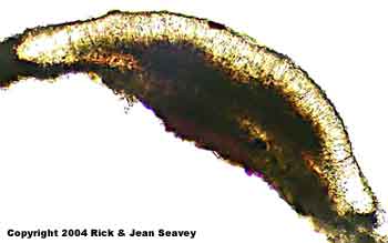 Byssoloma leucoblepharum thin section.