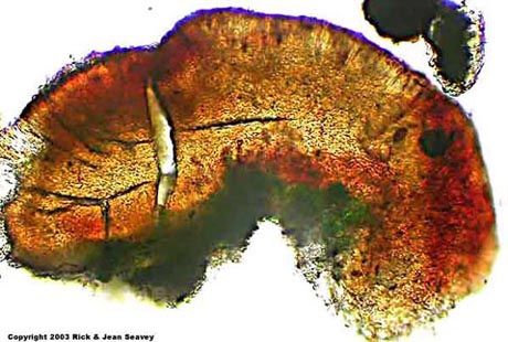 Phyllopsora buettneri thin section.