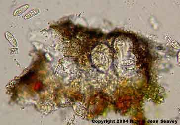 Arthothelium taediosum thin section and ascus.