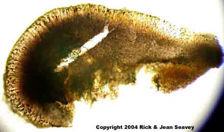 Coccocarpia erythroxyli thin section.