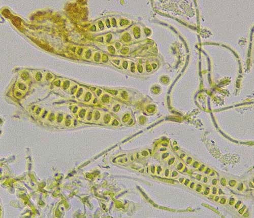 Acanthothecis floridensis spores
