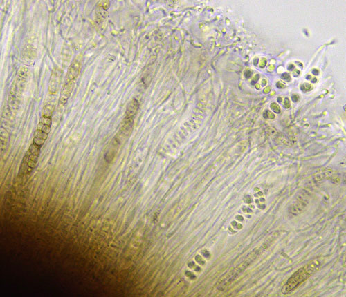 Ampliotrema auratum 