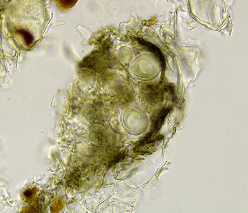 Arthonia hypochniza