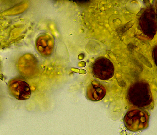 microsperma