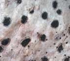 Arthonia platygraphidea