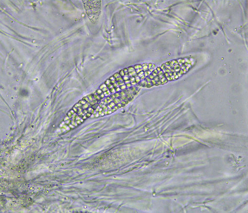 Aspidothelium cinerascens