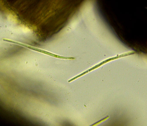 Bacidiopsora orizabana