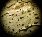 Celothelium aciculiferum